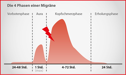 Migräne Verlauf