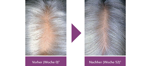 Vorher-Nachher Vorher-Nachher