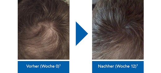 Vorher-Nachher Vorher-Nachher